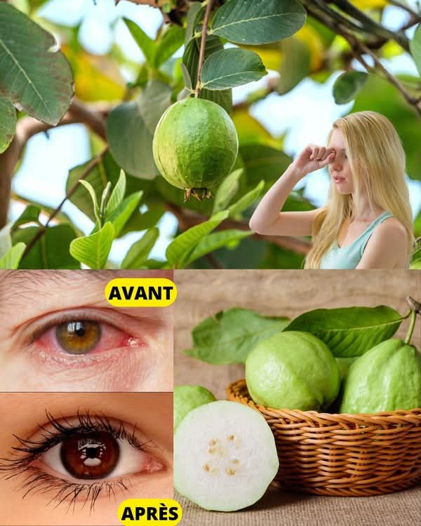 Le glaucome est une pathologie oculaire grave, souvent liée à une augmentation de la pression à l'intérieur de l'œil, qui peut endommager le nerf optique et mener à la cécité. Face à cette "maladie silencieuse", de nombreuses personnes cherchent à savoir s'il est possible de guérir le glaucome naturellement.