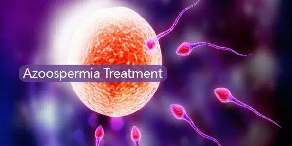 L'azoospermie, définie par l'absence totale de spermatozoïdes dans l'éjaculat, est souvent vécue comme un choc pour les hommes souhaitant fonder une famille. Qu'elle soit obstructive (blocage des canaux) ou sécrétoire (défaut de production), cette pathologie n'est pas toujours une fatalité. Si vous cherchez comment traiter l'azoospermie naturellement, la pharmacopée africaine offre des perspectives encourageantes pour stimuler la spermatogenèse.