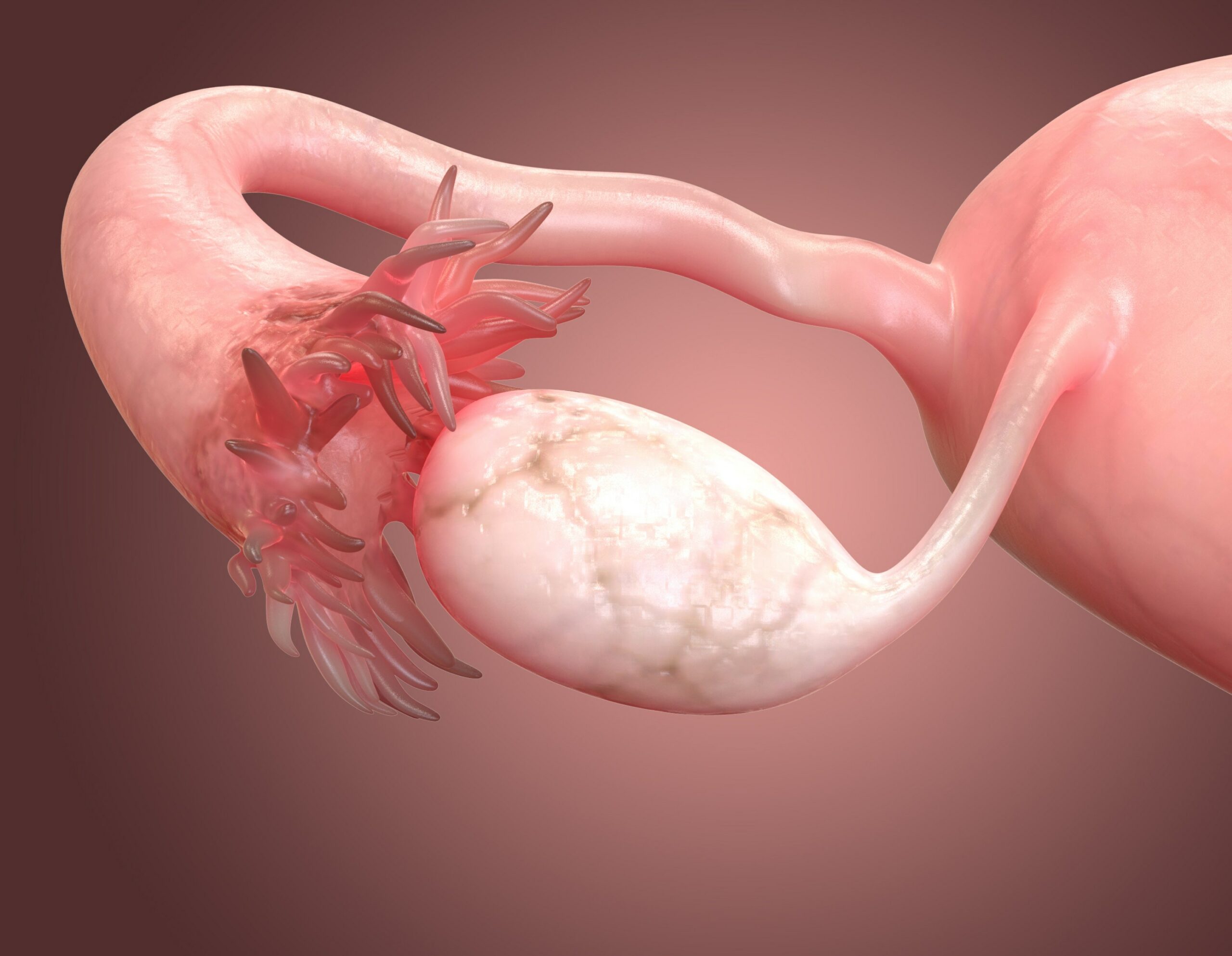 Les trompes de Fallope jouent un rôle fondamental dans la conception. C’est en leur sein que se rencontrent le spermatozoïde et l’ovule, et c’est par là que l’œuf voyage jusqu’à l’utérus. Malheureusement, l’obstruction tubaire (les trompes bouchées) est l’une des causes principales d’infertilité féminine. Qu’elle soit due à des infections passées, à de l'endométriose ou à des interventions chirurgicales, cette affection peut être évitée. S’informer sur la prévention des trompes bouchées naturellement est essentiel pour toutes les femmes qui souhaitent protéger leur fertilité future.